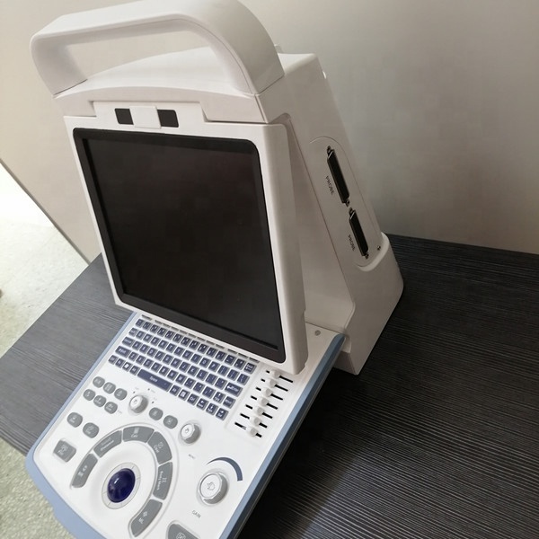 Hot sell pc based full digital portable ultrasound machine