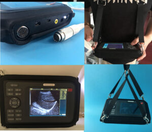 Portable and convenient palmtop handheld ultrasound function rectal convex ultrasound scanner