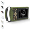2021 Full Digital Palmtop Bladder Ultrasound Scanner Color Ultrasound Machine With Convex